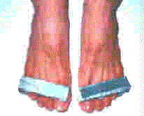 http://www.alexchiu.com/eternallife/footbrac.jpg