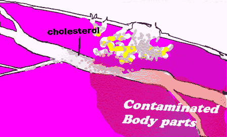 Contaminating cells